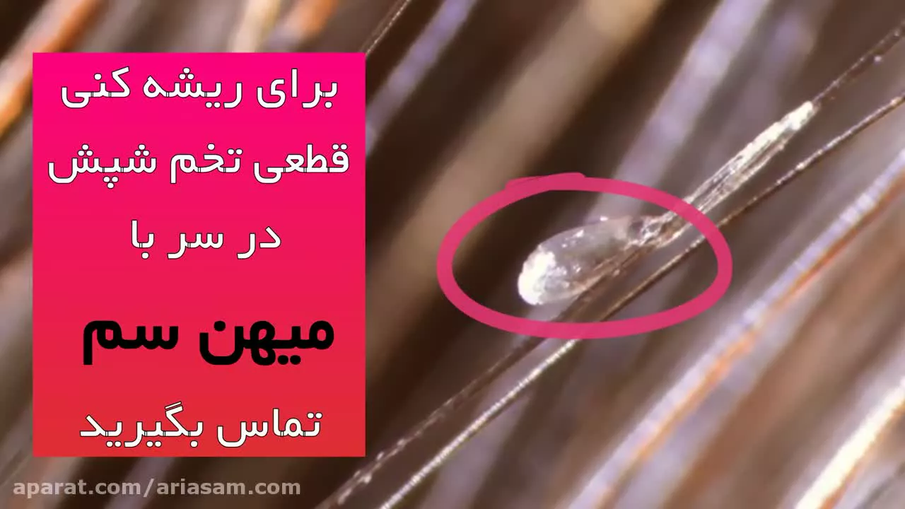 درمان شپش سر و تخم شپش | شامپو فوق العاده تاثیر گذار برای دفع شپش