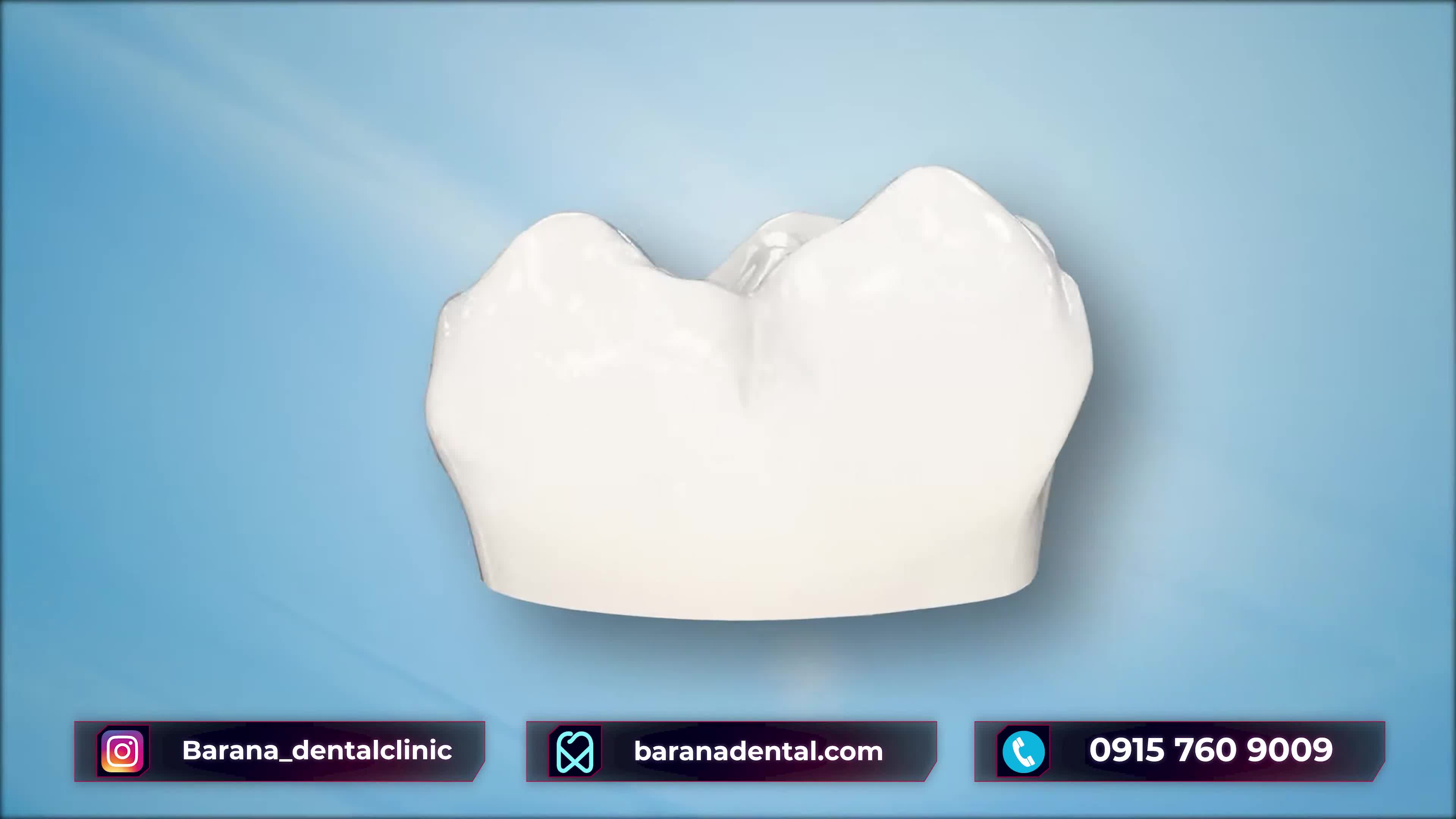 انجام انواع روکش دندان را در این ویدیو ببینید