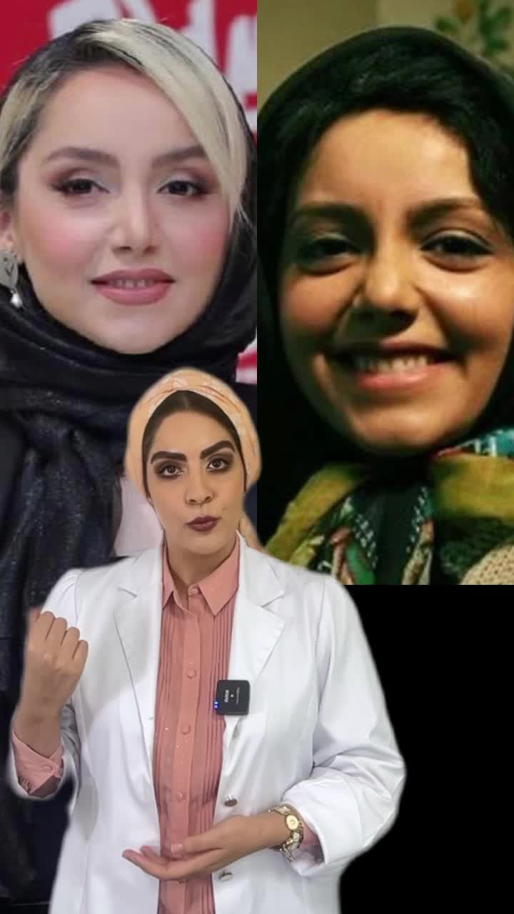   افشاگری یک متخصص از جراحی‌های زیبایی نازنین بیاتی