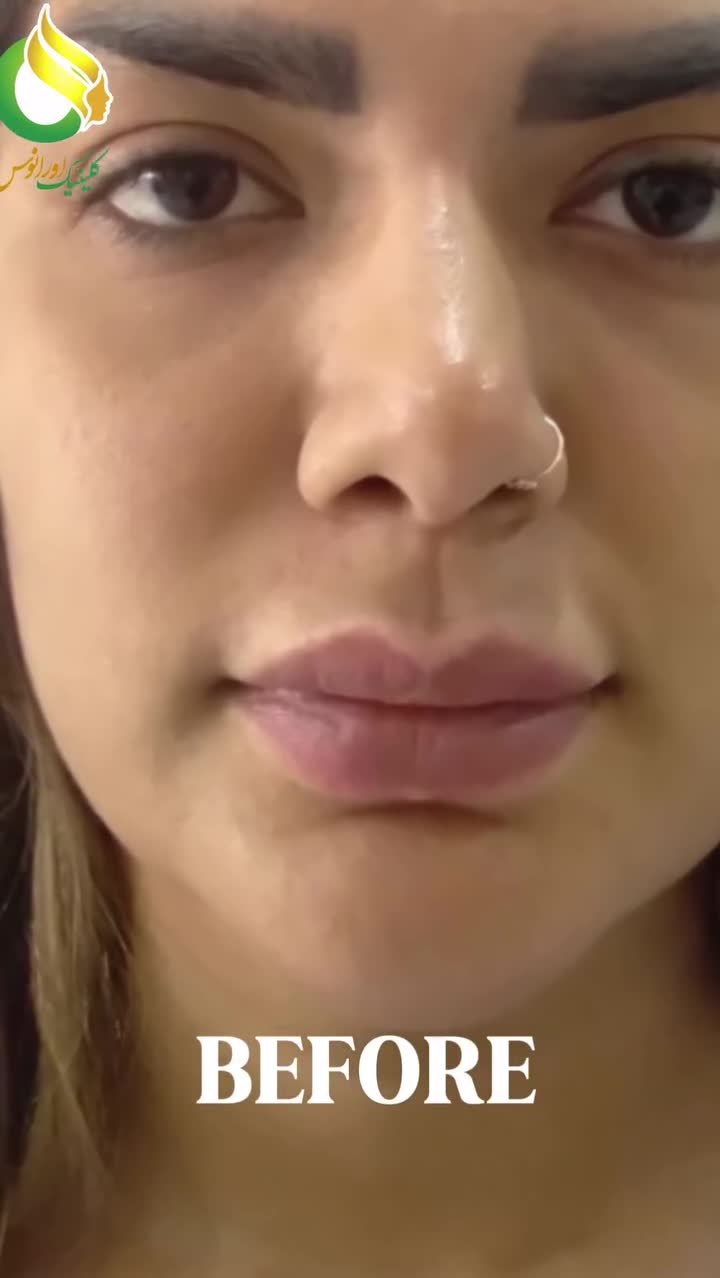 کلینیک زیبایی اورانوس