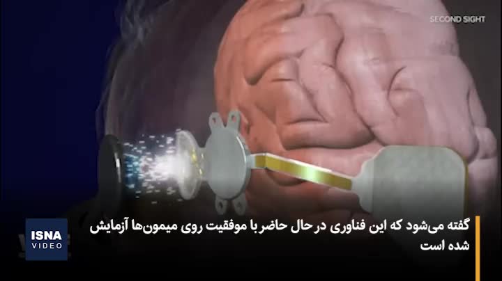 بینایی به افراد نابینا برمیگردد!