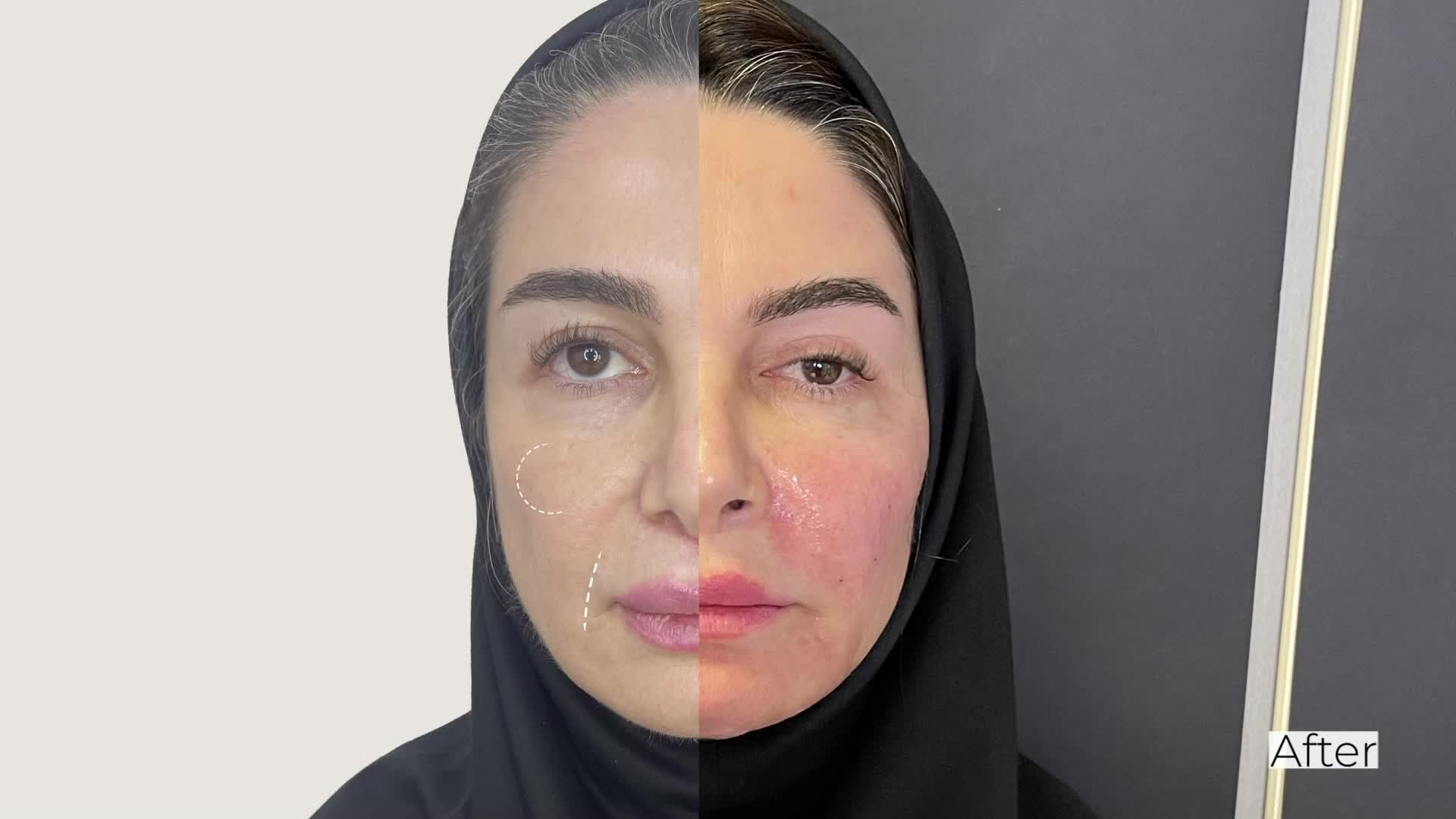 دکتر فواد متولی زاده / متخصص زیبایی