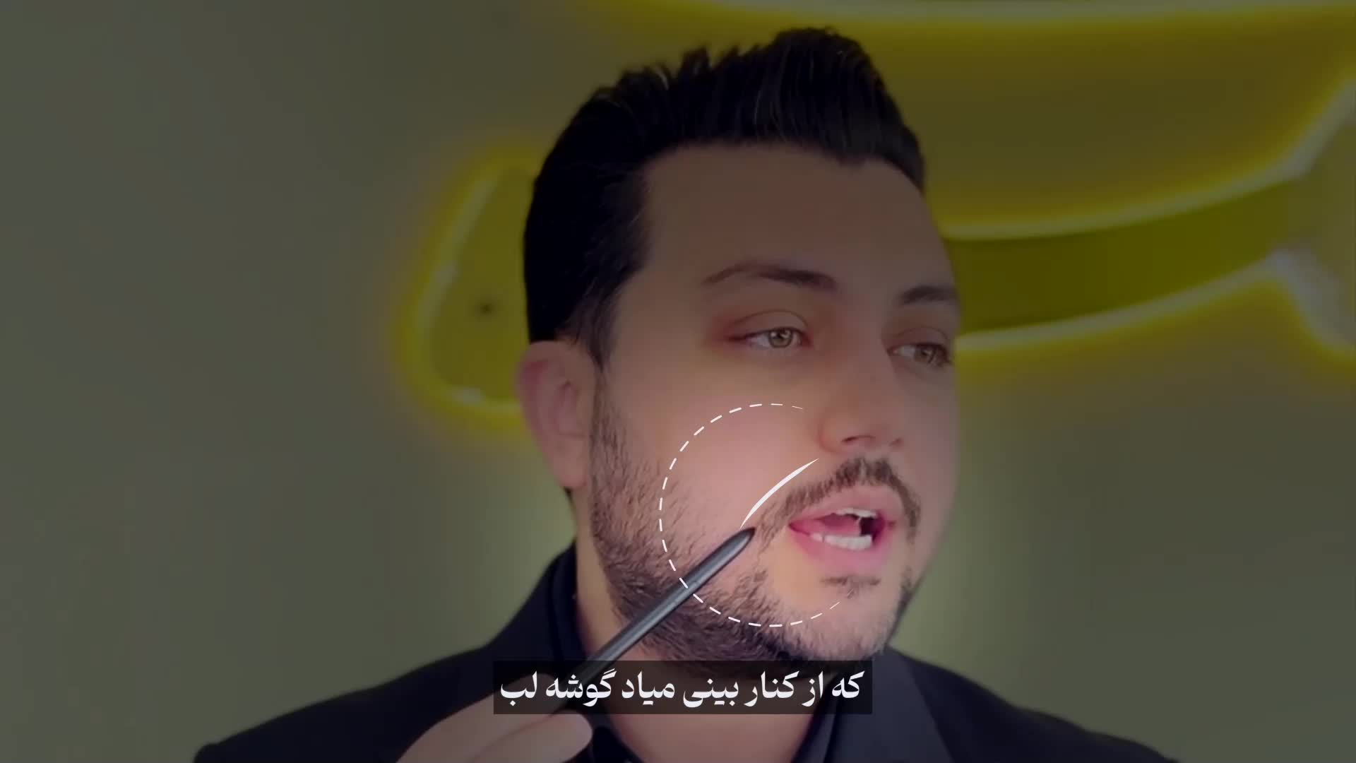 تزریق ژل برای خط خنده