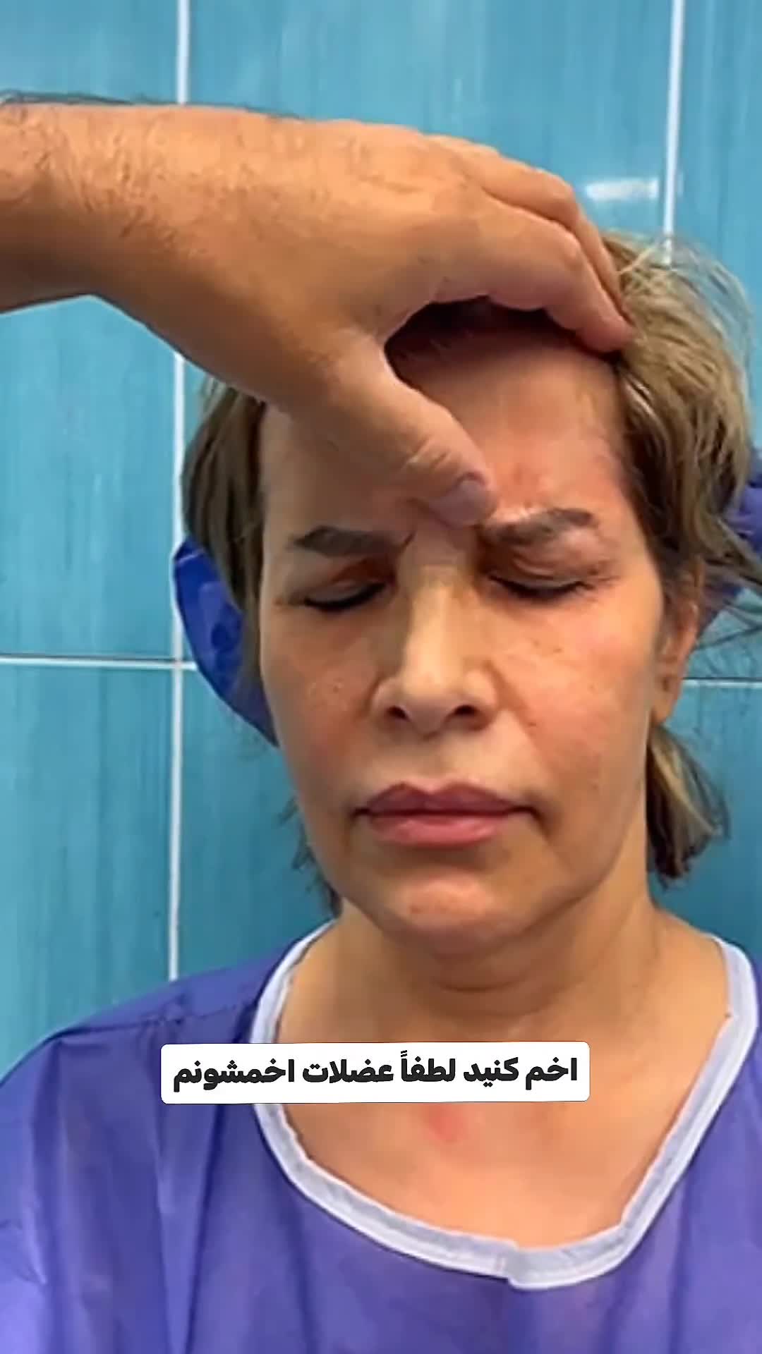 افتادگی ابرو، صورت و گردن