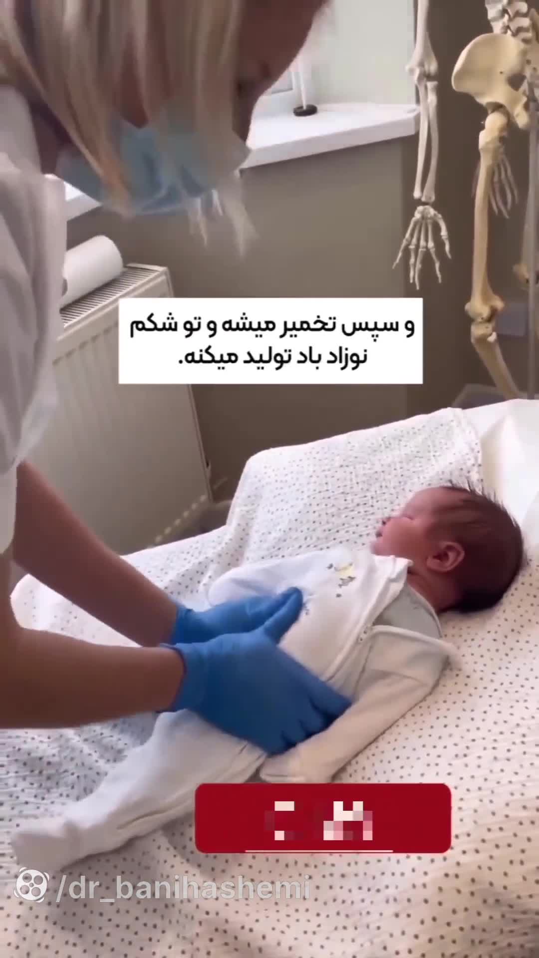 آشنایی با نفخ شکم نوزاد و راههای درمان آن