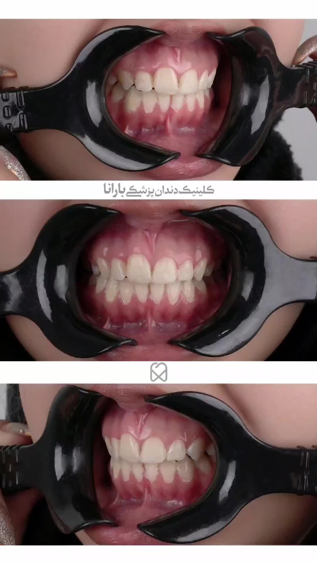 ارتودنسی دندان در کلینیک بارانا