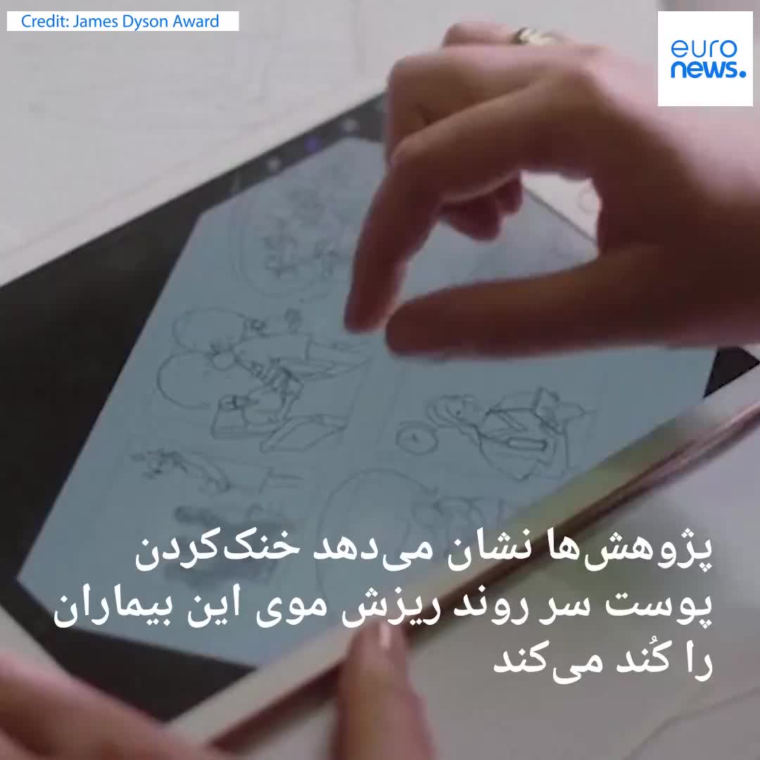    اختراع کلاه خنک‌کننده دانشجوی طراحی ایرلندی  برای بیماران سرطانی