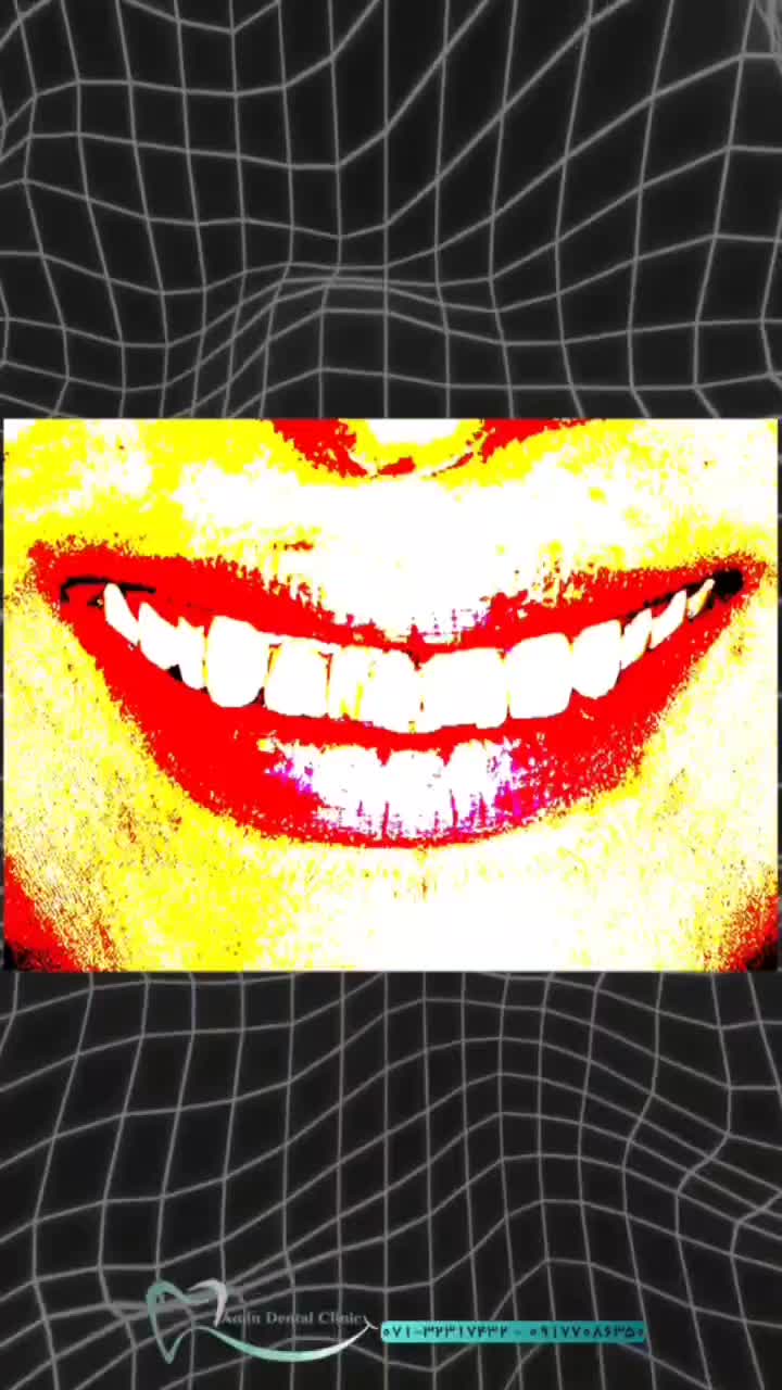 کامپوزیت دندان با کلینیک دندانپزشکی امین شیراز