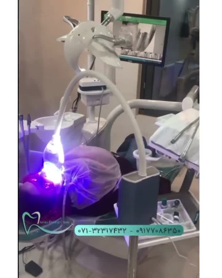 بلیچینگ دندان(سفید کردن دندان) با کلینیک دندانپزشکی امین شیراز