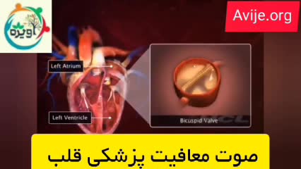 بیماری های قلبی که موجب معافیت می شوند