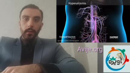 مراحل دریافت معافیت پزشکی نقرس