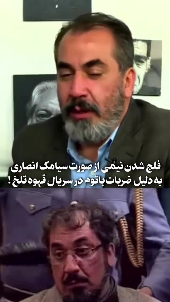   ماجرای فلج شدن نیمی از صورت سیامک انصاری برای بازی در سریال مهران مدیری