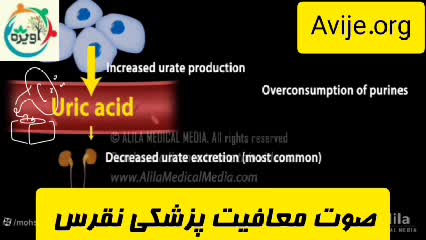 مراحل دریافت معافیت پزشکی نقرس