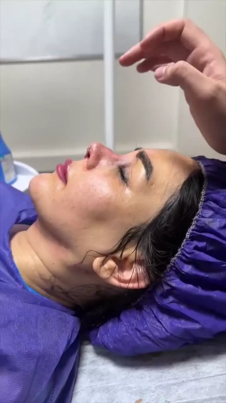 رضایت زیباجوی عزیز از تیپ پلاستی بینی در درمانگاه مسیح