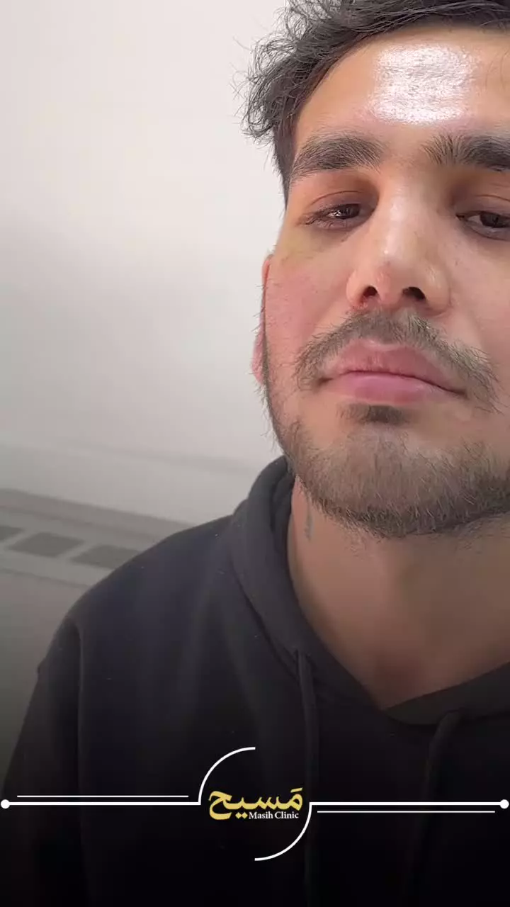 عمل بینی فانتزی مردانه در کلینیک مسیح