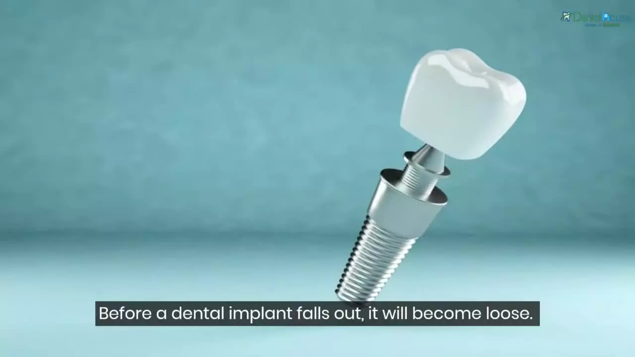 از ایمپلنتت صدای کلیک میاد؟ این ویدیو رو ببین!