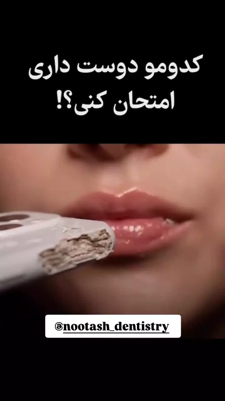 کدومو دوس داری امتحان کنی؟ _ کلینیک دندانپزشکی نوتاش