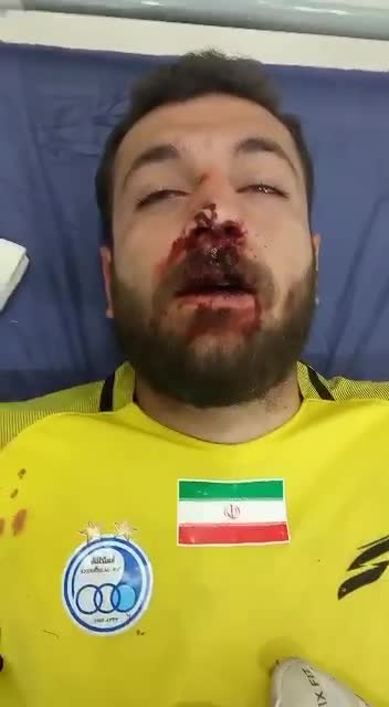   مصدومیت شدید، کار گلر استقلال را به اتاق عمل کشاند