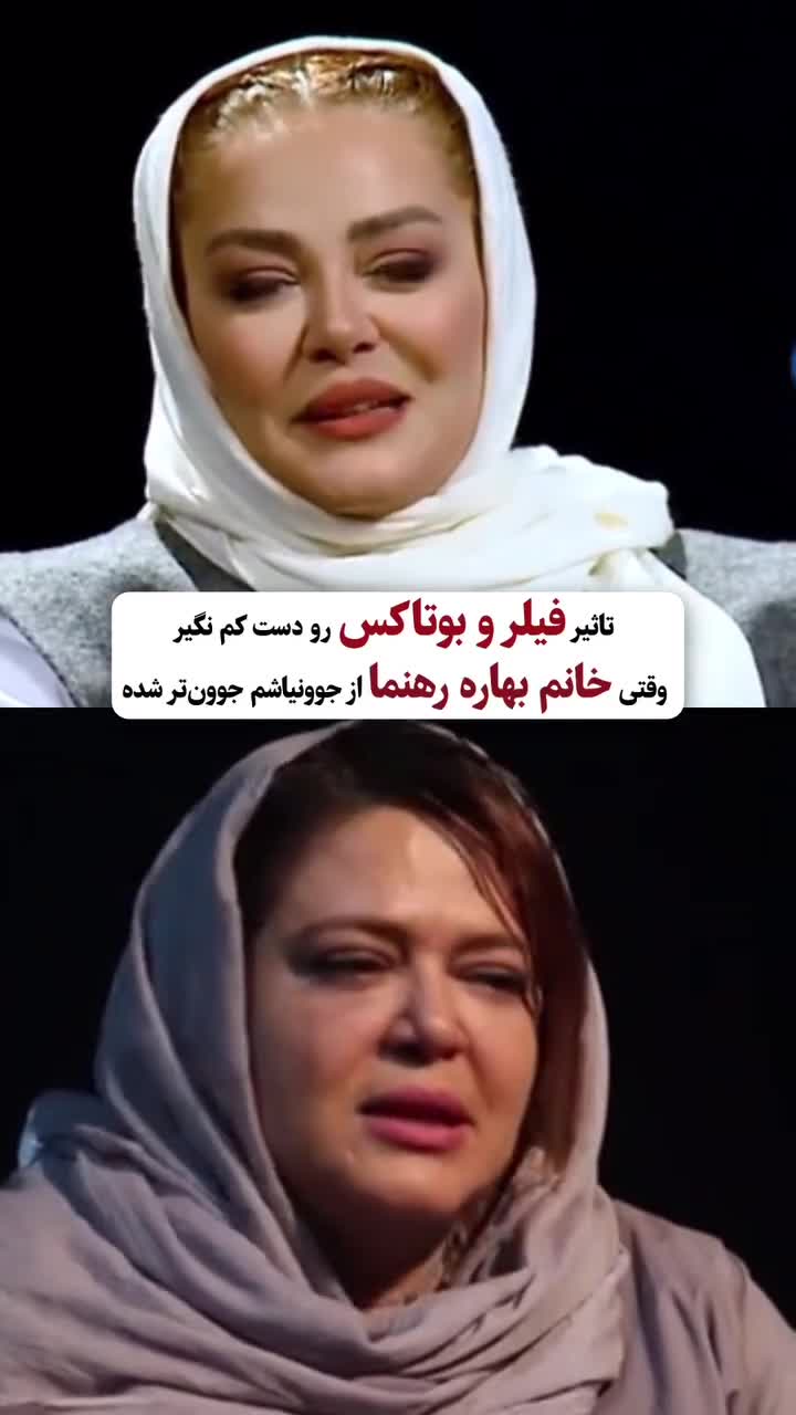 عملهای زیبایی بهاره رهنما
