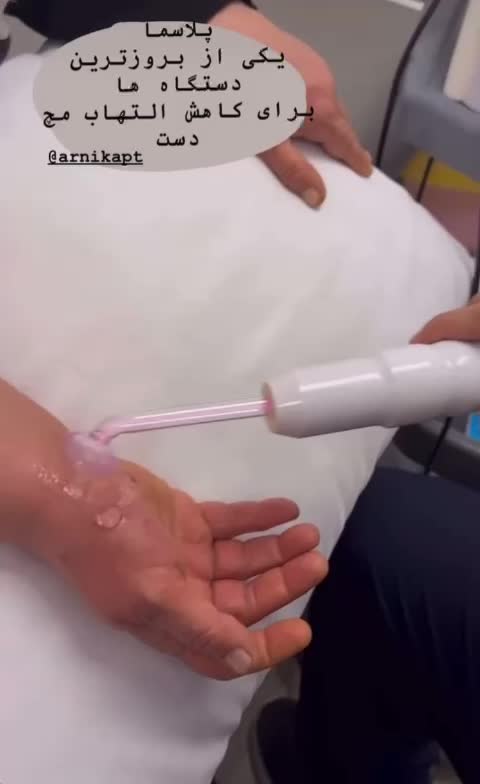 کاهش التهاب مچ دست با دستگاه پزشکی پلاسماالکتروسرجیکال