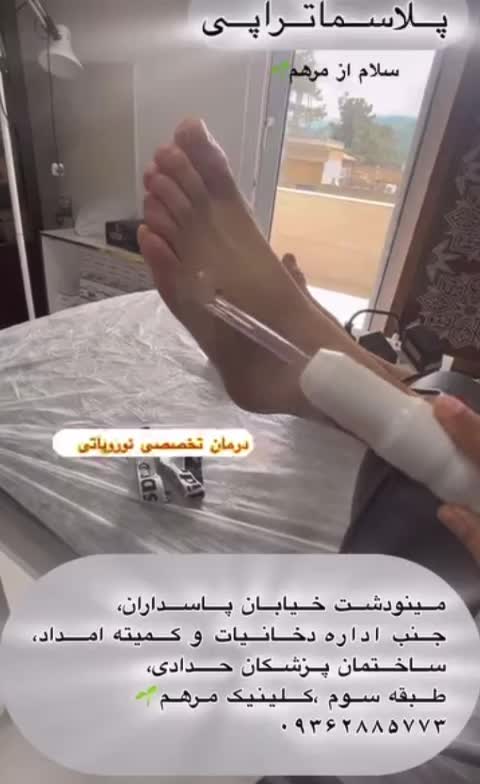 دستگاه پزشکی پلاسماالکتروسرجیکال