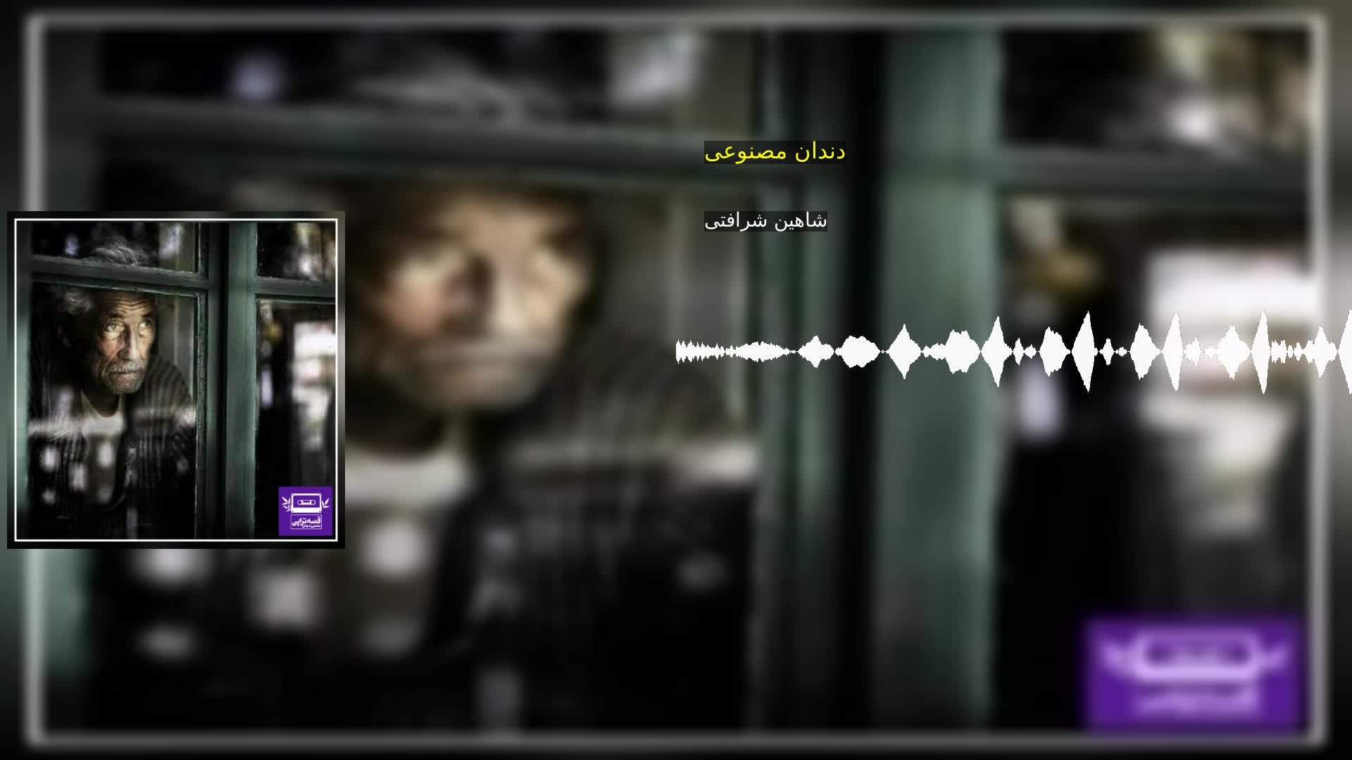 دانلود دندان مصنوعی شاهین شرافتی