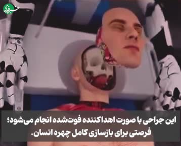 جراحی تغییر چهره کامل با ۱۲۸ میلیارد! واقعیت یا جنون؟ | 5 مرداد 1404