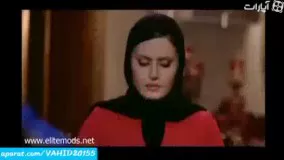 سینمایی الناز شاکردوست و قضیه عمل بینی