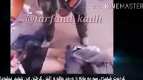 شهید مدافع حرم که داعشی ها نه میتونن چاقو تو بدنش فرو کنن نه آتش میگیرد