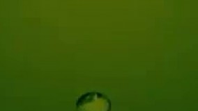 درمان سرگیجه