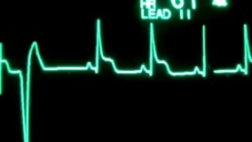 آخرین تلاشهایی که قلب یه آدم واسه برگشت به زندگی انجام میده به تعداد ضربان قلب در دقیقه توجه کنید.چق