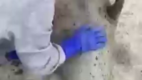 اره دکتر  دقیقا  همونجا درد میکنه 