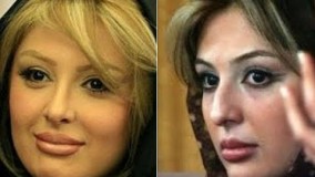 بازیگران مشهور ایرانی قبل از عمل بینی