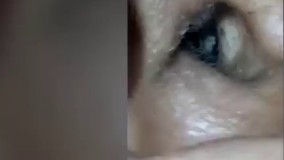 یک زن هندی که برای درمان سردرد به بیمارستان مراجعه کرد