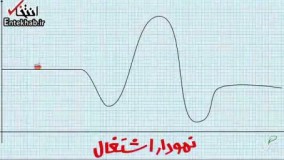 فیلم/ واکنش «دیرین دیرین» به فیلتر شدن تلگرام