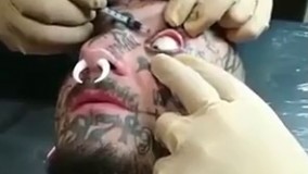 خالکوبی در چشم