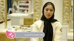 یادانه - این قسمت "مراقبت های بعد از اکستنشن"