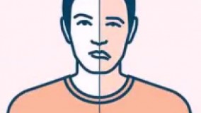 آموزش تشخیص سکته مغزی 