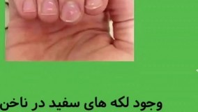  ناخـــــن ها » در مورد سلامتی شما چه میگویند ⁉️