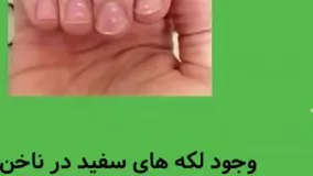  ناخـــــن ها » در مورد سلامتی شما چه میگویند ⁉️