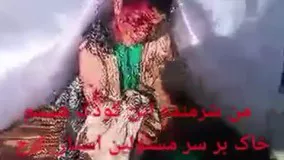 پسربچه كارتن‌خواب در کرج که مورد حمله سگهای گرسنه قرار گرفته.دلخراش