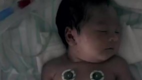 یکی از دوقلوها  که مرده بود، ولی با شنیدن تپش قلب مادرش زنده میشه 