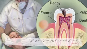 22 عادتی که دندان‌ها را خراب می‌کنند