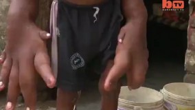 دستای 37 کیلویی و عجیب پسر هندی 