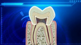 Green tea compound may protect sensitive teeth