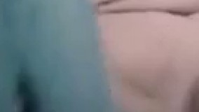 از عوارض های سینگلی