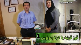  قوز قرنیه یا کراتوکونوس