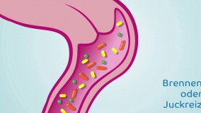 درمان دارویی عفونت قارچی واژن-آموزش استفاده از ضدعفونی کننده واژن 