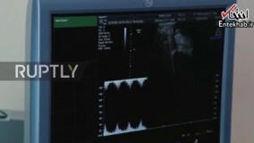 فیلم/ پرینت سه بعدی از جنین درون شکم مادر!