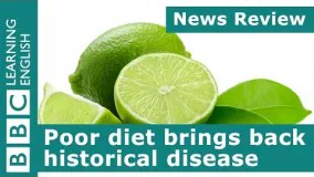 BBC News Review: Poor diet brings back historical disease